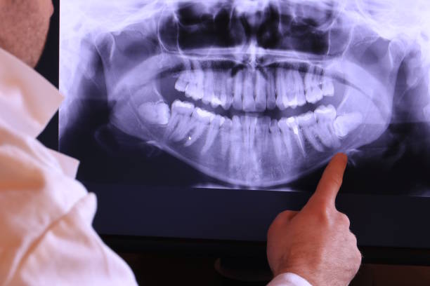 Best Emergency Dental Care for Broken or Chipped Teeth in Plain City, UT