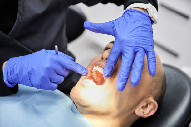 Best Emergency Gum Treatment in Plain City, UT